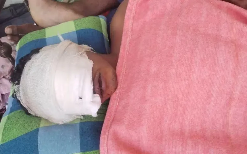 আঘাতের যন্ত্রণায় দিন কাটছে তানভীরের, ১১৫ দিনেও গ্রেফতার নেই কোনো আসামি।