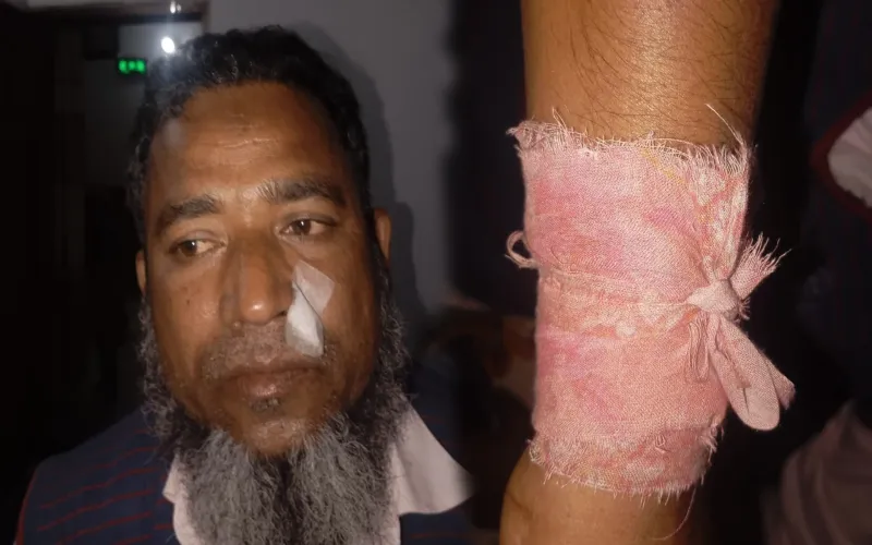 ধারের টাকা ফেরত না দিয়ে পাওনাদারকেই পেটালেন বিএনপি সভাপতি ও তার ছেলে !